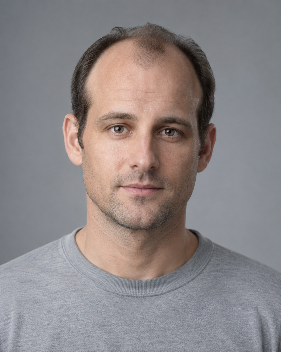 Man with a receding hairline against a gray backdrop. Model shown.